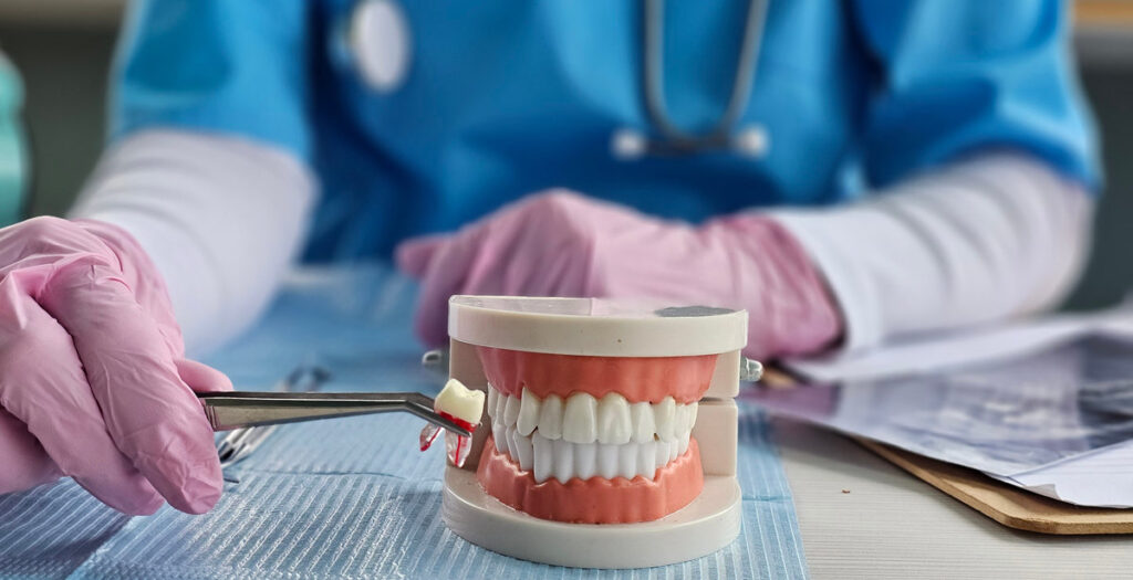 Tooth extraction and pediatric teeth surgery concept. Caries and dental treatment